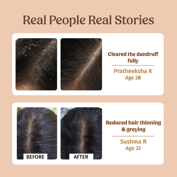 Herbal Shampoo (Dandruff Control)