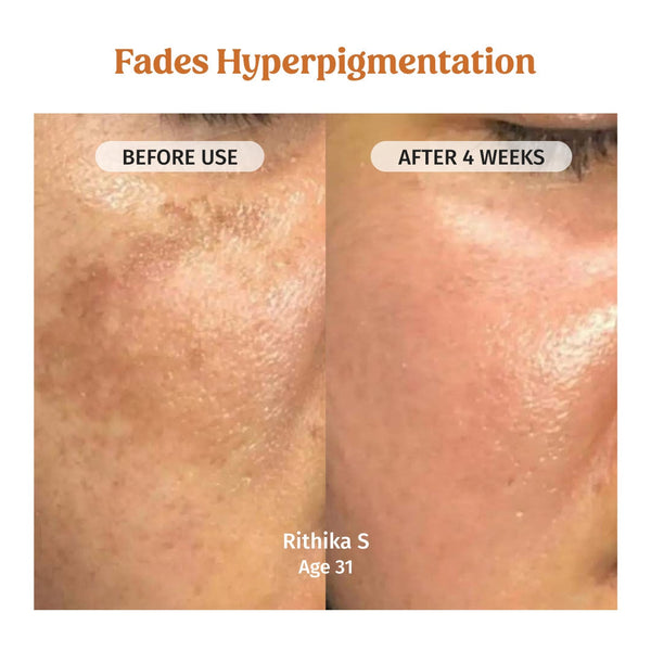 Face Brightening Combo