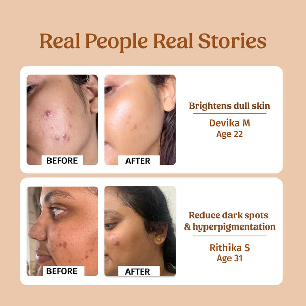 40ml Milk Drops Brightening Serum